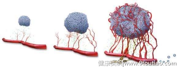 终于找到癌症的祸根，医生提醒：不要指望食物抗癌，防癌要这样做