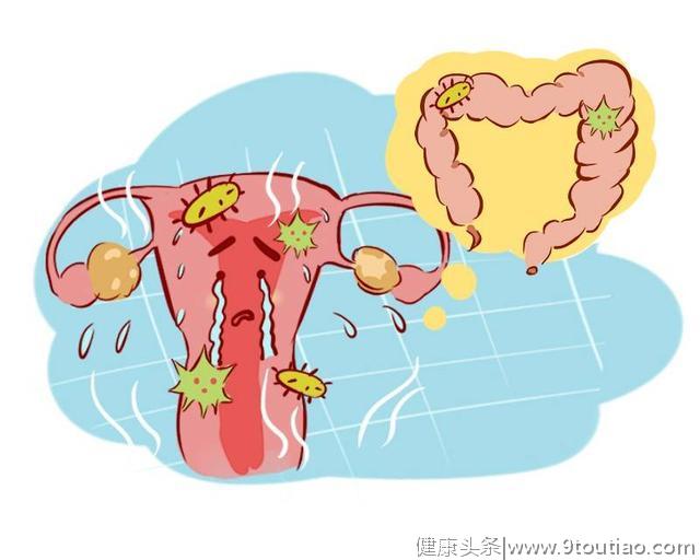 女性子宫健康与否，看这4点便可测出，不妨对照自查