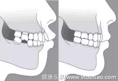 牙齿问题可申请这些减免，每一项都与你的钱包息息相关