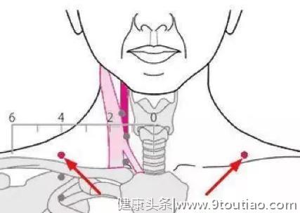 一觉醒来脖子僵硬？中医支招：按这三个穴位自救，立即缓解