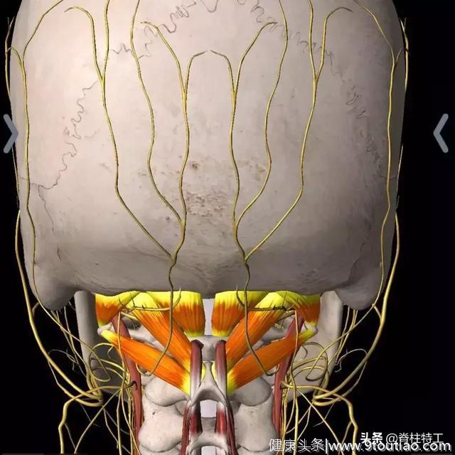 颈椎最重要的肌肉：头颈疼痛、视力模糊都怪它？