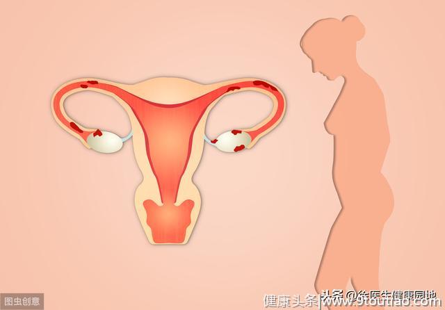辟谣！女性常喝四物汤，子宫肌瘤反而变大？想多了