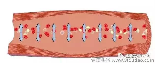 三分钟读懂，高血压、心悸