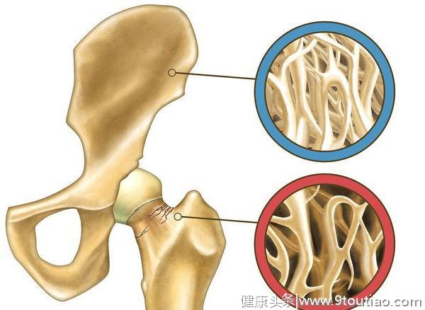 什么是骨感染病？该怎样去预防？