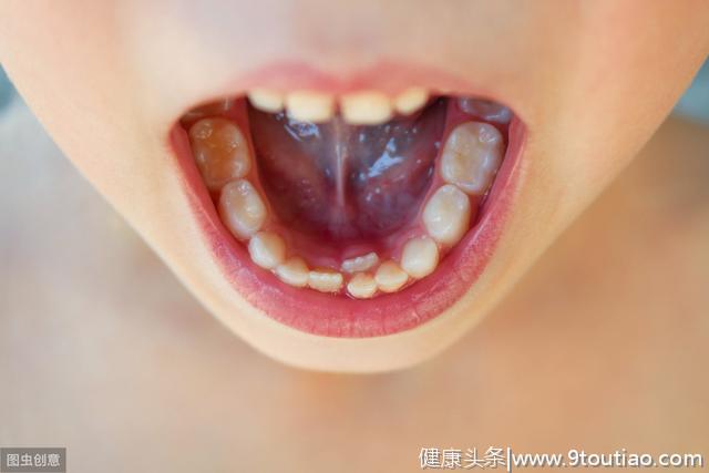 小孩子嘴里有钢牙，这是什么东西，有什么作用？