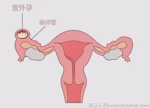 刚发现怀孕后，别光顾着高兴，这3件事要先确认一遍