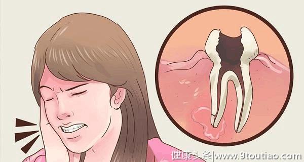 因为一颗烂牙，女子患上口腔癌！医生：这些口腔毛病要小心