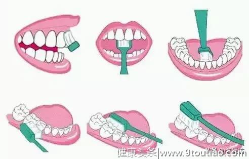 「牙周炎」是整掉你牙齿的罪魁祸首