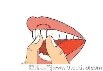 「牙周炎」是整掉你牙齿的罪魁祸首