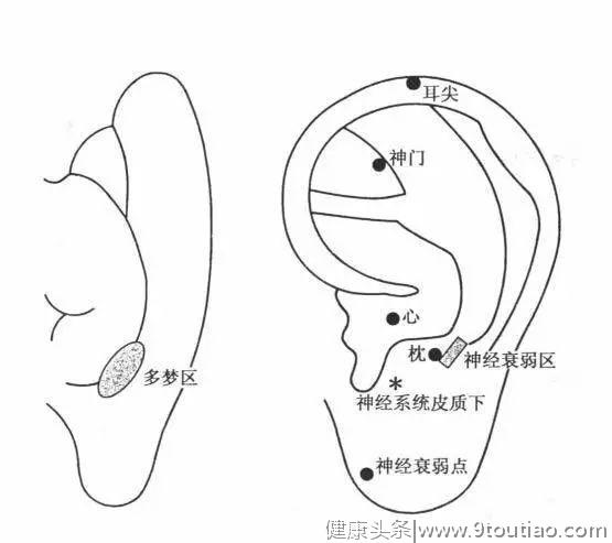 中医放血疗法：耳尖放血治病多，疗效显著易操作