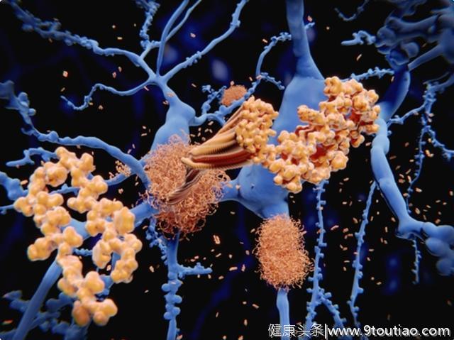 研究发现：如何使癌症干细胞对免疫系统可见