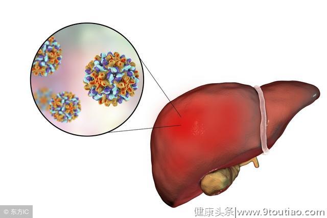 身体有7个明显表现说明摊上肝炎了，注意4点，避免肝炎成肝癌