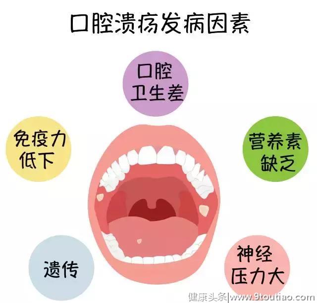 别人都以为我是一个不苟言笑的人，其实我只是一直在长口腔溃疡