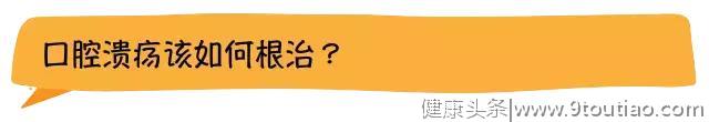 别人都以为我是一个不苟言笑的人，其实我只是一直在长口腔溃疡