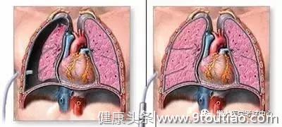 10分钟搞定呼吸系统