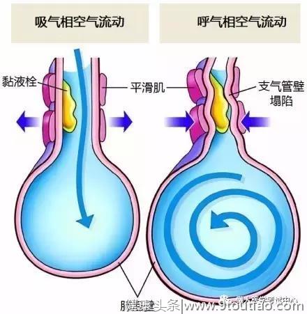 10分钟搞定呼吸系统