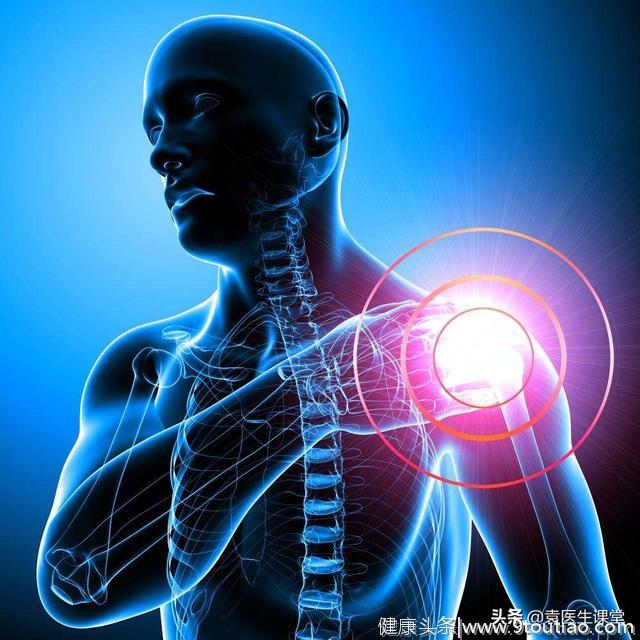 骨质增生和肩周炎是什么关系？医生：骨刺长在肩关节会引起肩周炎