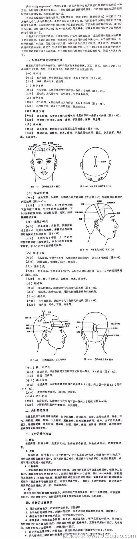 针灸论-棱针法与头针