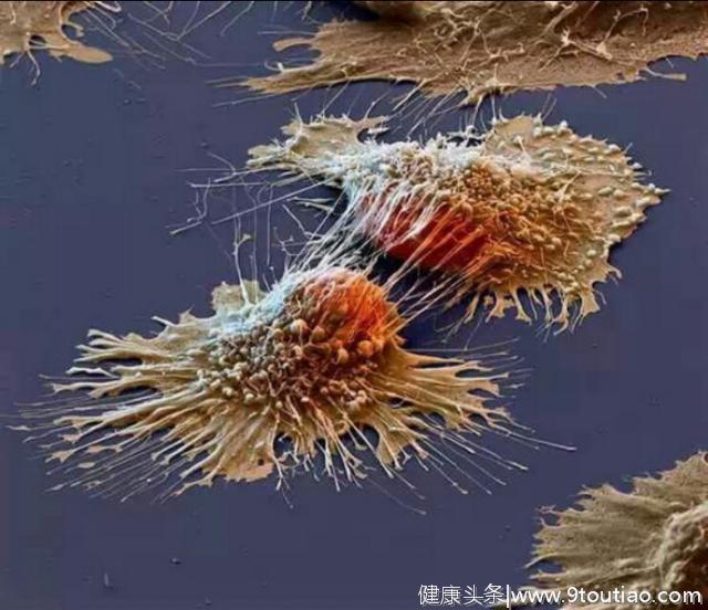 癌细胞要活下来，很不容易！能发展成癌症，也很不容易！