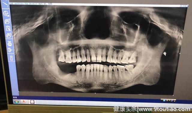 @最可爱的人，保定市口腔医院建军节发放免费进口种植体