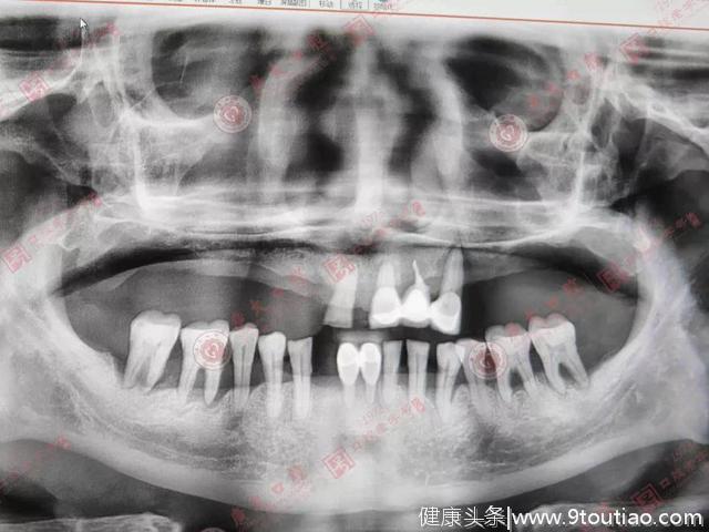 为了家为了孙子也为了能享清福，他终于要解决“老掉牙”问题了