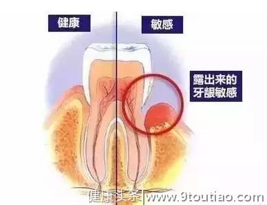 我的牙齿就靠牙石撑着了！谁敢给我洗牙，我跟谁急