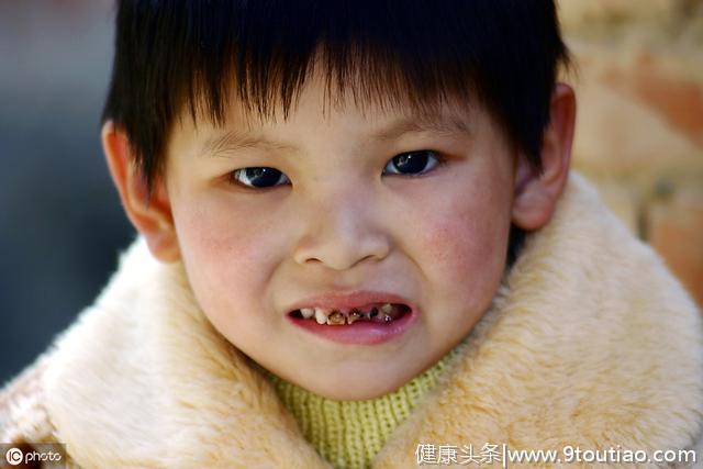 七岁小孩竟有多达526颗牙齿，网友：如果是印度的就不奇怪了