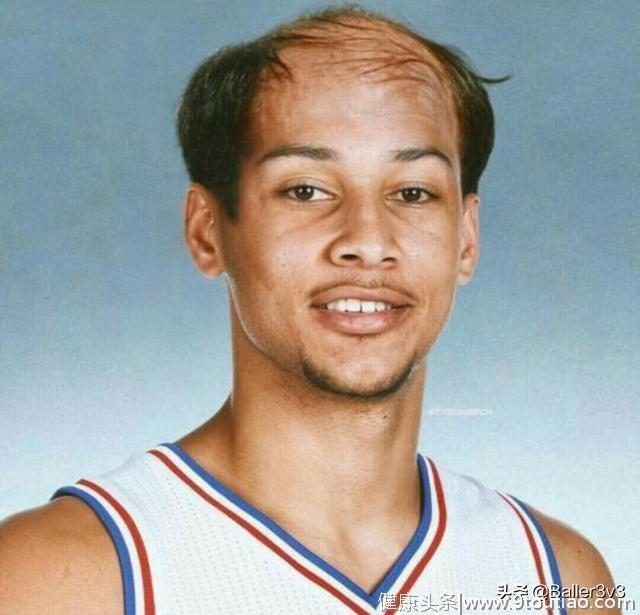 乔丹曾因为脱发与护发产品解约，到底有多少NBA球员有脱发困扰？