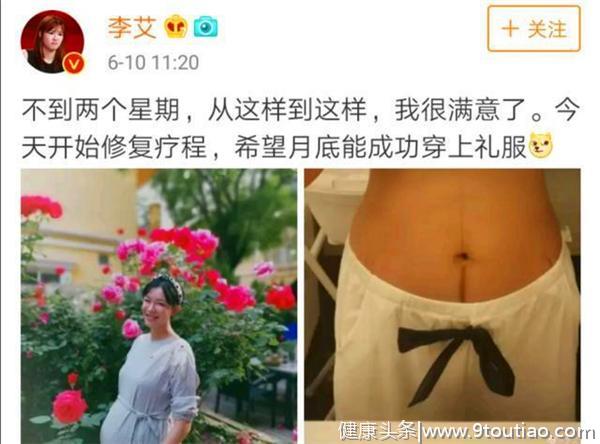 怀孕9个月，麦迪娜孕肚白皙，李艾妊娠线黝黑，和怀孕年龄有关？