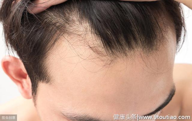能治疗脱发的药材与中成药，依据《中国药典》