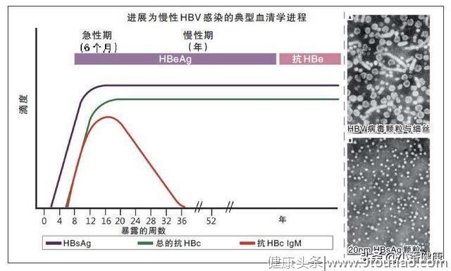 e抗原阴性慢乙肝指什么，也属于小三阳，日后病情发展迅速