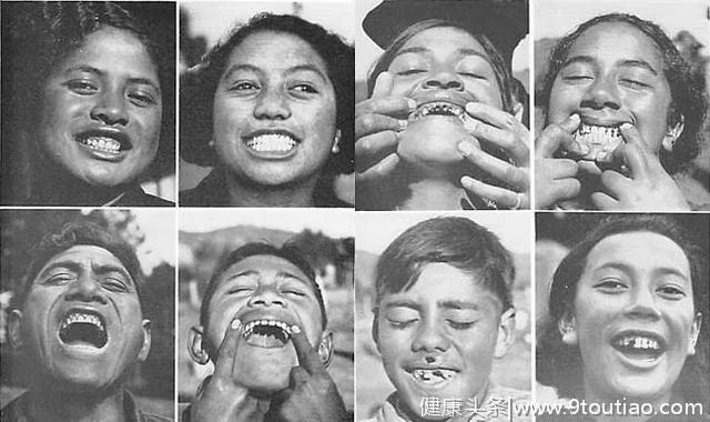 加拿大牙医Price：用时十年周游世界，发现保护牙齿的正确饮食