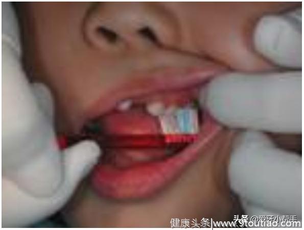 儿童牙齿清洁方法 看这篇就够了 如何替小孩清洁牙齿