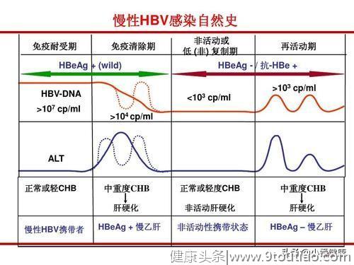 慢乙肝防治的核心是抗病毒