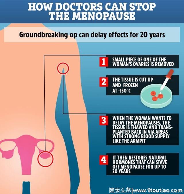 医学重大突破！女性可通过手术推迟更年期至少20年，价格不到6万