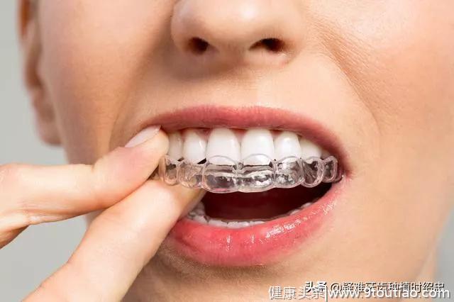 做牙齿矫正前，你接受这些治疗了吗？