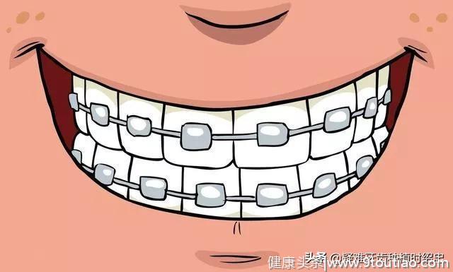 做牙齿矫正前，你接受这些治疗了吗？