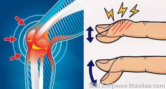 关节老是响会不会得关节炎？要警惕病理性的关节响