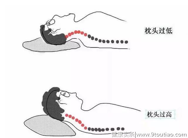 颈椎生理曲度变直怎么办？教你6个保护颈椎的方法，远离颈椎病