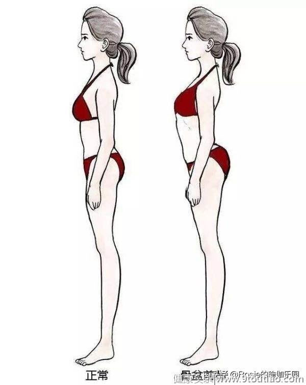 小腿粗、有青筋、肥胖纹，怎么瘦腿祛纹？哪些体式可以缓解腰痛？