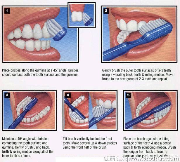 保姆级牙齿护理攻略！牙膏、智齿、科学刷牙、洗牙、牙齿美白