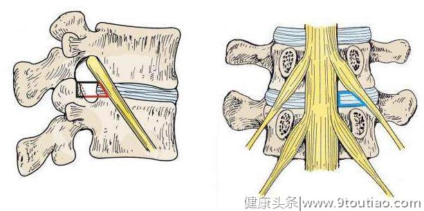 容易被误诊为腰间盘突出的11种腰部疾病，医生的医术很关键