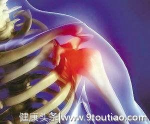 肩膀疼痛不只是肩周炎这么简单，还有5个病因都要小心