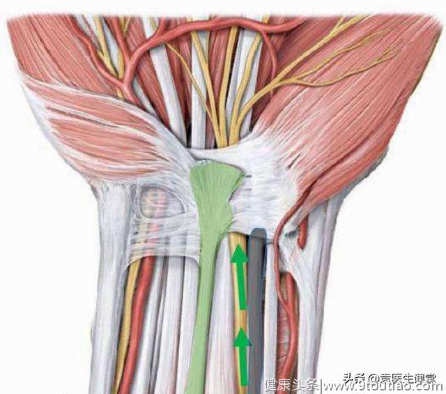 类风湿关节炎所引起的腕管综合征，会导致3个半手指麻木、疼痛