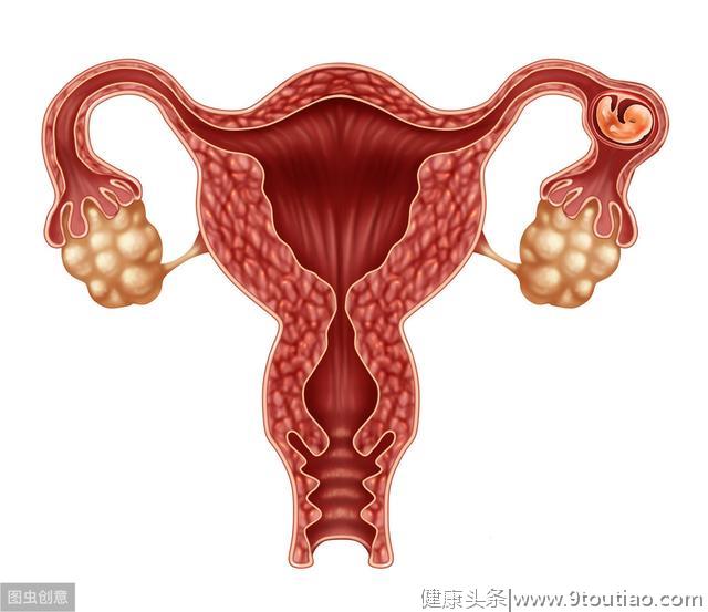 这6种子宫肌瘤，需要及时治疗