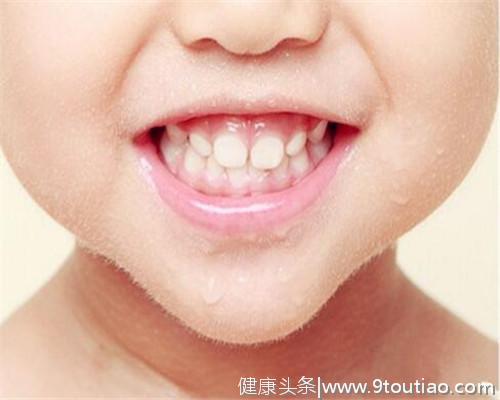 宝宝蛀牙怎么办？如何有效预防孩子蛀牙？