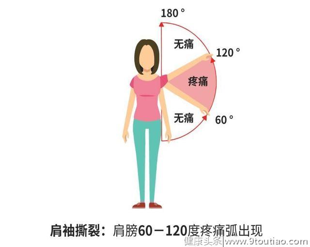 肩痛≠肩周炎，运动医学专家教你区分肩痛的几种常见疾病