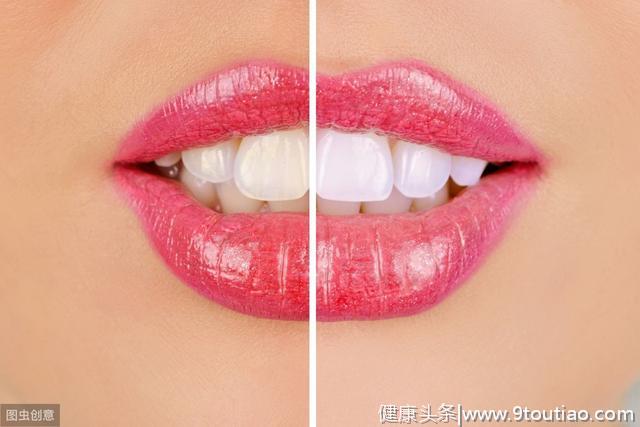 牙齿冷光美白会导致牙齿敏感？真相究竟是什么？