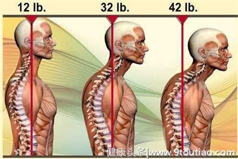 上班族该怎么保护颈椎？康复师：学好这四招，让颈椎病远离你