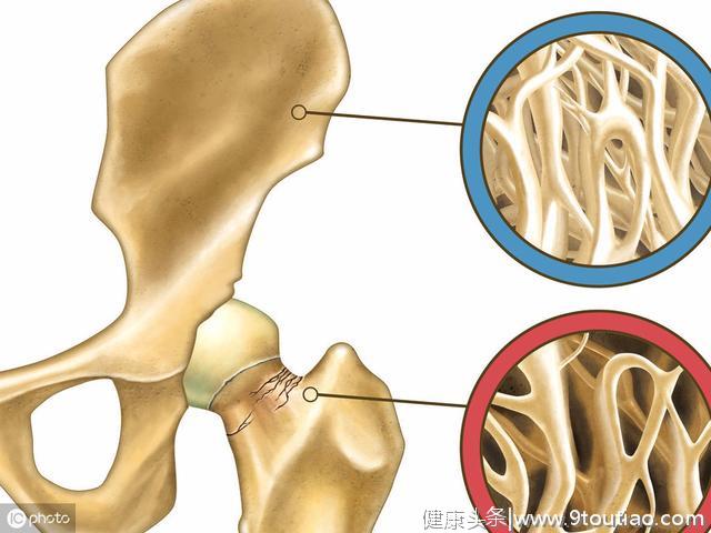 怎么改善更年期综合征？这种方法可以延迟更年期20年